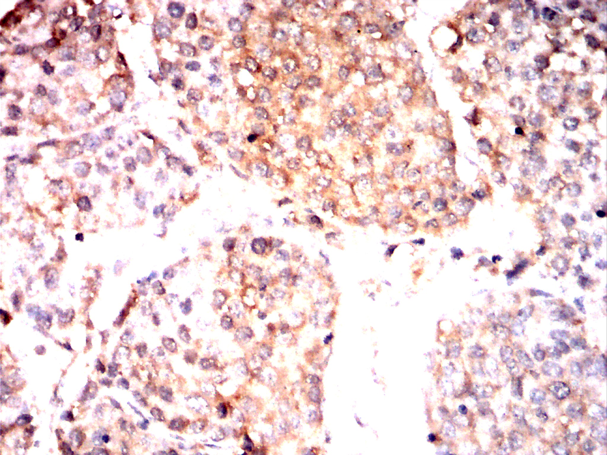 IHC 